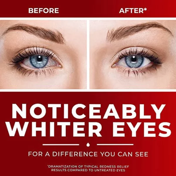 Collyre Contre Les Yeux Rouges Clear Eyes Maximum Red Eye Relief 15 mL – Image 2