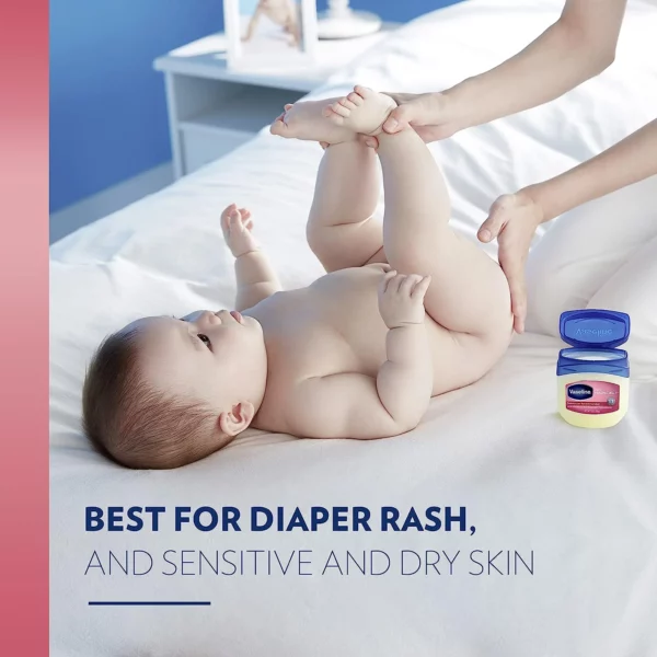 Vaseline Pour Bébé 100% Pure Petroleum Jelly, Soin Protecteur Hypoallergénique 368g – Image 2