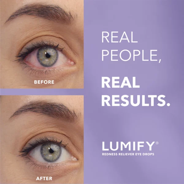 LUMIFY - Anti-Rougeur, Yeux Plus Blancs & Éclatants, 7.5 mL – Image 2